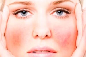 Причины дерматита на лице