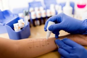 Диагностика аллергии - проведение кожных проб