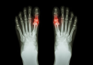 Рентген суставов ног
