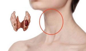 Опасность сбоя в работе щитовидки